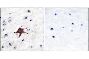 Immunohistochemistry (IHC) image for anti-Solute Carrier Family 2 (Facilitated Glucose Transporter), Member 3 (SLC2A3) (AA 447-496) antibody (ABIN1533295)