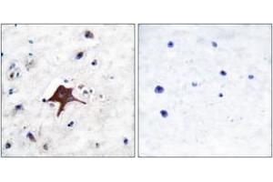 Immunohistochemistry analysis of paraffin-embedded human brain tissue, using GLUT3 Antibody.