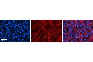 Immunohistochemistry (IHC) image for anti-Acyl-CoA Synthetase Long-Chain Family Member 1 (Acsl1) (C-Term) antibody (ABIN2777590)