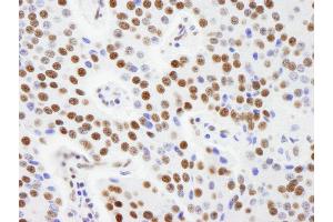Immunohistochemistry (IHC) image for anti-A Kinase (PRKA) Anchor Protein 8-Like (AKAP8L) (AA 596-646) antibody (ABIN7448929) (AKAP8L 抗体  (AA 596-646))