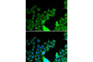 Immunofluorescence analysis of HeLa cells using BCL2L14 antibody. (BCL2L14 抗体)