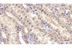 Detection of FGF3 in Human Kidney Tissue using Polyclonal Antibody to Fibroblast Growth Factor 3 (FGF3) (FGF3 抗体  (AA 154-232))