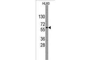 Western blot analysis of anti-GNL3 Antibody (Center) (R) in HL60 cell line lysates (35 μg/lane). (Nucleostemin 抗体  (AA 191-220))