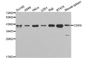 Western blot analysis of extracts of various cell lines, using CDK9 antibody. (CDK9 抗体  (AA 153-372))