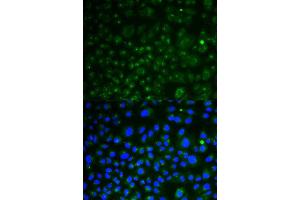Immunofluorescence analysis of HeLa cell using LAMP1 antibody. (LAMP1 抗体  (AA 80-280))
