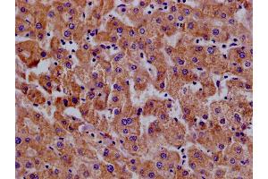Immunohistochemistry of paraffin-embedded human pancreatic tissue using ABIN7156641 at dilution of 1:100 (MX1 抗体  (AA 7-172))
