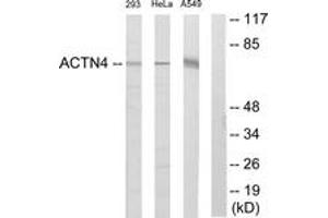 Western blot analysis of extracts from 293/HeLa/A549 cells, using ACTN1/2/3/4 Antibody. (ACTN1/2/3/4 抗体  (AA 21-70))