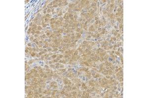 Immunohistochemistry of paraffin-embedded rat ovary using DC Rabbit mAb (ABIN7266685) at dilution of 1:200 (40x lens). (DCAF7 抗体)