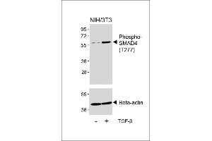 Western blot analysis of lysates from NIH/3T3 cell line, untreated or treated with TGF-β(100 ng/mL, 30 min), using Phospho-SD4 Antibody (upper) or Beta-actin (lower). (SMAD4 抗体  (pThr277))
