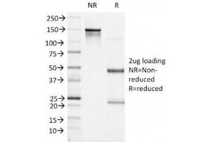 SDS-PAGE Analysis of Purified, BSA-Free Bcl6 Antibody (clone BCL6/1527). (BCL6 抗体  (AA 256-389))