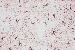 Immunohistochemistry (IHC) image for anti-Glial Fibrillary Acidic Protein (GFAP) (AA 93-432) antibody (ABIN3043832)
