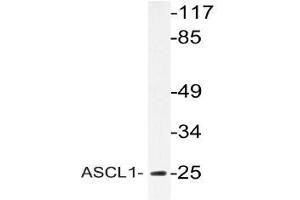 Western blot (WB) analyzes of ASCL1 antibody in extracts from Jurkat cells.