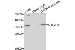 Immunoprecipitation analysis of 200ug extracts of HT-29 cells using 1ug GTF2H3 antibody. (GTF2H3 抗体  (AA 1-308))
