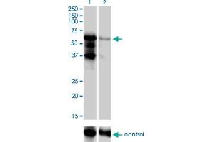 Western blot analysis of PKNOX2 over-expressed 293 cell line, cotransfected with PKNOX2 Validated Chimera RNAi (Lane 2) or non-transfected control (Lane 1). (PKNOX2 抗体  (AA 116-215))