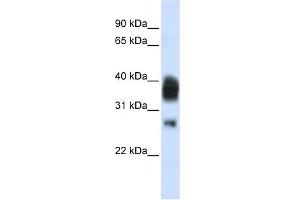 WB Suggested Anti-RNASEH1 Antibody Titration:  0. (Ribonuclease H1 抗体  (Middle Region))
