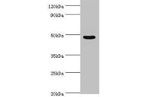 Western blot All lanes: Evolutionarily conserved signaling intermediate in Toll pathway, mitochondrial antibody at 10 μg/mL + Jurkat whole cell lysate Secondary Goat polyclonal to rabbit IgG at 1/10000 dilution Predicted band size: 50, 34, 25 kDa Observed band size: 50 kDa (ECSIT 抗体  (AA 185-431))