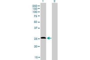 Western Blot analysis of C20orf18 expression in transfected 293T cell line by C20orf18 monoclonal antibody (M01), clone 3C3. (RBCK1 抗体  (AA 3-99))