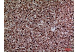 Immunohistochemistry (IHC) analysis of paraffin-embedded Human Liver, antibody was diluted at 1:100. (CEACAM1/5 抗体  (N-Term))