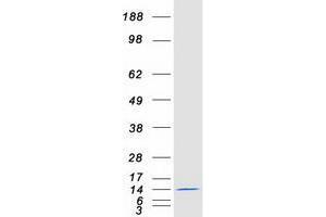 Western Blotting (WB) image for Ubiquitin Related Modifier 1 (Urm1) (Transcript Variant 1) protein (Myc-DYKDDDDK Tag) (ABIN2735070)