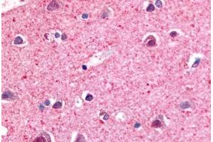Immunohistochemistry (IHC) image for anti-Nuclear Receptor Subfamily 4, Group A, Member 3 (NR4A3) (Modulating Domain) antibody (ABIN1049140)