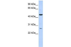 WB Suggested Anti-C6orf199 Antibody Titration: 0. (AKD1 抗体  (Middle Region))