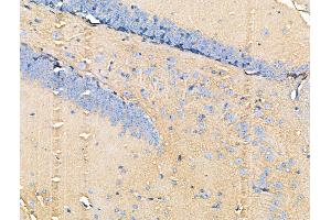 ABIN6259937 and ABIN6266496 at 1/100 staining Mouse brain tissue by IHC-P.