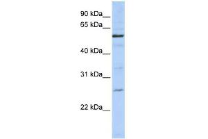 WB Suggested Anti-ZGPAT Antibody Titration:  0. (ZGPAT 抗体  (C-Term))
