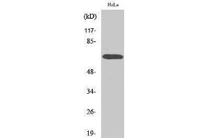 Western Blotting (WB) image for anti-V-Raf Murine Sarcoma 3611 Viral Oncogene Homolog (ARAF) (Ser155) antibody (ABIN3183344)