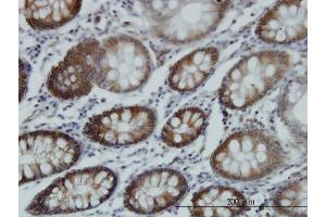 Immunostaining (ISt) image for anti-Rhotekin (RTKN) (AA 451-549) antibody (ABIN562746)