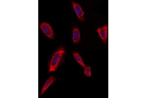ABIN6259341 and ABIN6275460 staining Hela by IF/ICC. (RAB20 抗体  (Internal Region))