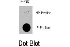 Image no. 1 for anti-3-phosphoinositide Dependent Protein Kinase-1 (PDPK1) (pSer396) antibody (ABIN358390) (PDPK1 抗体  (pSer396))