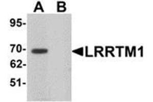 Western blot analysis of LRRTM1 in mouse brain tissue lysate with LRRTM1 antibody at 1 μg/ml in (A) the absence and (B) the presence of blocking peptide. (LRRTM1 抗体  (C-Term))