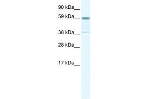 Human Liver; WB Suggested Anti-TRIM41 Antibody Titration: 0. (TRIM41 抗体  (C-Term))