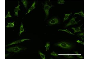 Immunofluorescence of monoclonal antibody to RARA on HeLa cell. (Retinoic Acid Receptor alpha 抗体  (AA 315-424))