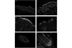 Immunohistochemical staining of repetin using anti-Repetin, pAb (AF646)  and FITC-labeled anti-rabbit IgG antibody on frozen section of human skin (A), human foreskin (B), human tongue (C and D) and human hair follicles (E and F). (Repetin 抗体  (AA 570-584))