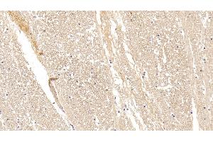 Detection of CPLX1 in Human Cerebrum Tissue using Polyclonal Antibody to Complexin 1 (CPLX1) (Complexin 1 抗体  (AA 1-134))