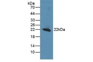 Detection of Recombinant REV1, Human using Polyclonal Antibody to REV1 Homolog (REV1) (REV1 抗体  (AA 301-478))