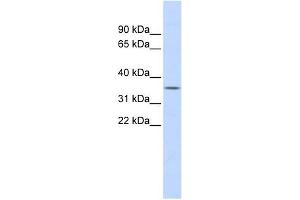 FCN1 antibody used at 1 ug/ml to detect target protein.
