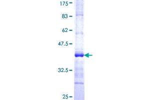 ALAS1 Protein (AA 1-98) (GST tag)