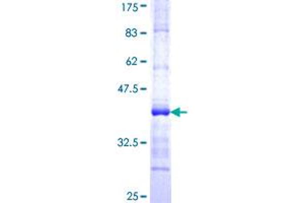 ALAS1 Protein (AA 1-98) (GST tag)