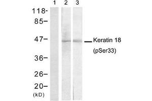 Western blot analysis of extracts from A431 cells (Lane 1 and 2) and EC-304 cells (Lane 3) using Keratin 18 (Phospho-Ser33) antibody (E011306). (Cytokeratin 18 抗体  (pSer33))