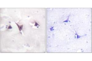 Immunohistochemistry analysis of paraffin-embedded human brain tissue, using Trk B (Ab-515) Antibody. (TRKB 抗体  (AA 481-530))