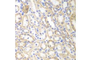 Immunohistochemistry (Paraffin-embedded Sections) (IHC (p)) image for anti-Sirtuin 3 (SIRT3) (C-Term) antibody (ABIN6147792)