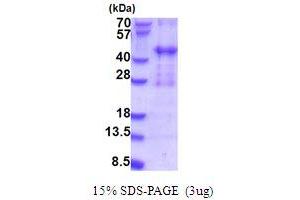 PIH1 Domain Containing 2 (PIH1D2) (AA 1-315) protein (His tag)