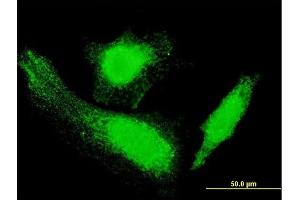 Immunofluorescence of monoclonal antibody to HTT on HeLa cell. (Huntingtin 抗体  (AA 81-190))