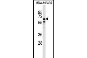 Western blot analysis in MDA-MB435 cell line lysates (35ug/lane). (TRIM39 抗体  (AA 248-277))