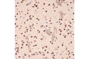 Immunohistochemistry of paraffin-embedded mouse brain using EHMT2 Rabbit mAb (ABIN7265616) at dilution of 1:100 (40x lens). (EHMT2 抗体)