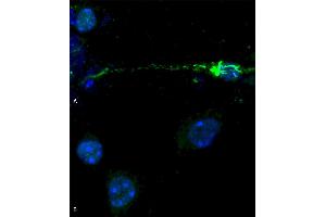 Phospho serine 129 antibody (ABIN5650947) was used to detect phosphorylated alpha synuclein in primary mouse hippocampal neurons treated with 100 nM sonicated mouse alpha synuclein PFFs (ABIN5651245) (A). (SNCA 抗体  (pSer129) (Biotin))