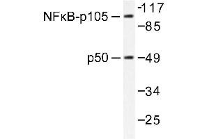 Image no. 1 for anti-Nuclear Factor of kappa Light Polypeptide Gene Enhancer in B-Cells 1 (NFKB1) antibody (ABIN271742) (NFKB1 抗体)
