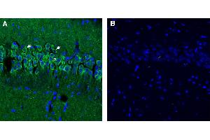 Free-floating frozen brain sections from a paraformaldehyde-perfused mouse were incubated with Anti-Synaptojanin 1 antibody (ABIN7885553, 1:300), followed by goat anti-rabbit secondary antibody conjugated to Alexa Fluor® 488 (green). (Synaptojanin 1 抗体  (Intracellular))